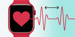 Meranie stresu a variability srdcového tepu smart hodinkami